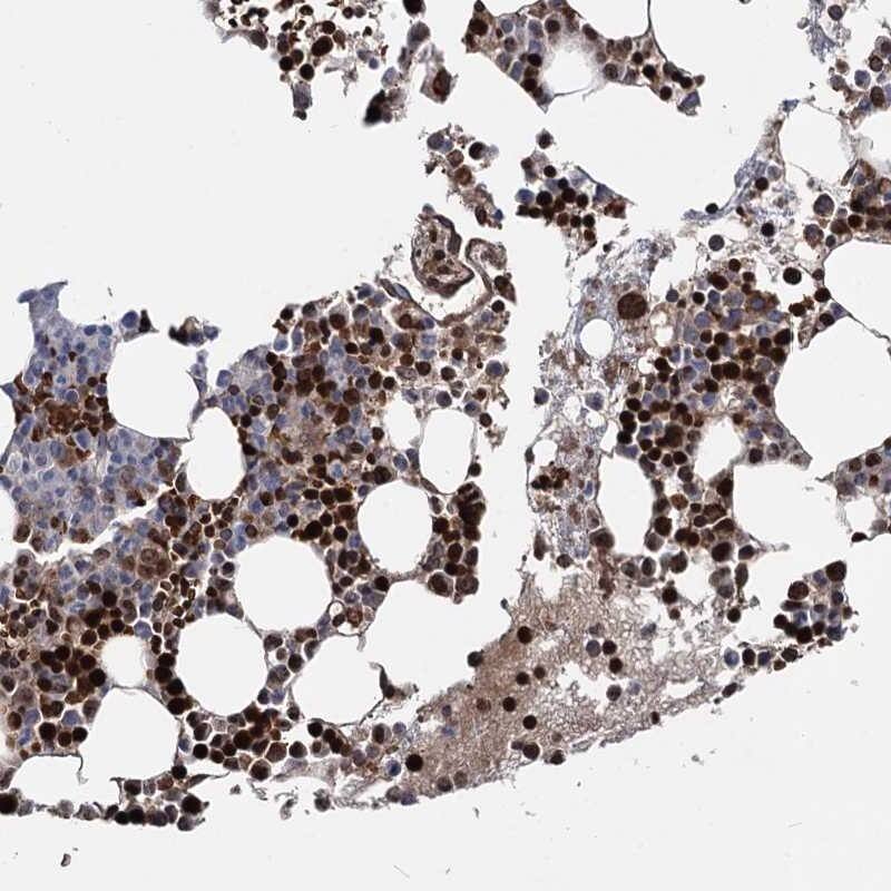 Staining of human bone marrow shows strong nuclear positivity in bone marrow poietic cells.