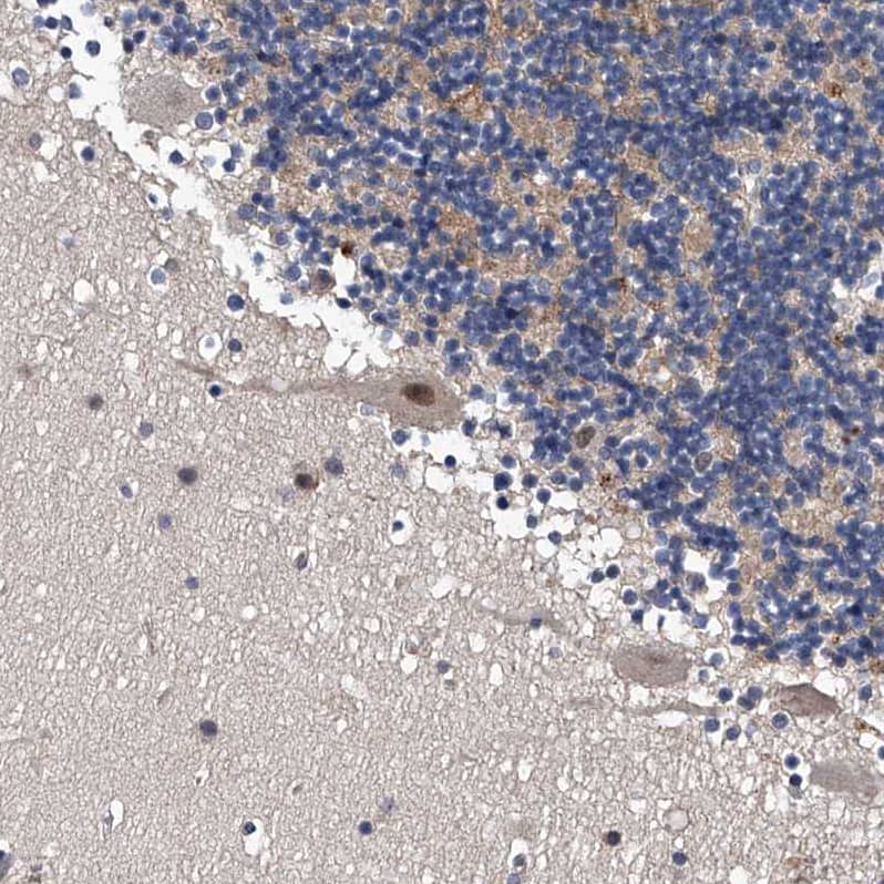 Immunohistochemistry-Paraffin ZNF30 Antibody - BSA Free