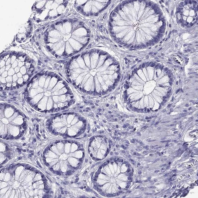 Staining of human lymph node using Anti-AAK1 antibody HPA017931.