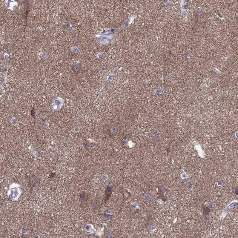 Staining of human pancreas shows low expression as expected.