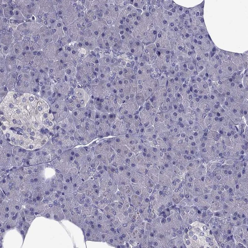 Staining of human liver using Anti-AAK1 antibody HPA017931.
