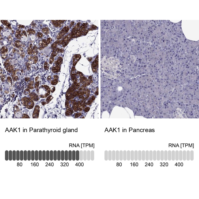 Analysis in human parathyroid gland and pancreas tissues using Anti-AAK1 antibody. Corresponding AAK1 RNA-seq data are presented for the same tissues.