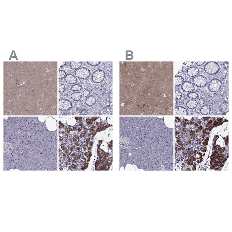 <b>Independent Antibodies Validation. </b>Staining of human colon, liver, lymph node and parathyroid gland using Anti-AAK1 antibody HPA020289 (A) shows similar protein distribution across tissues to independent antibody NBP1-84110 (B).