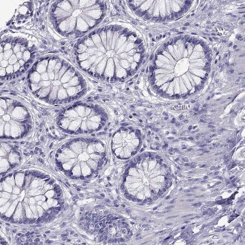 Staining of human liver using Anti-AAK1 antibody HPA020289.