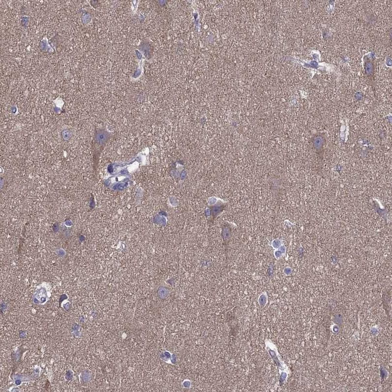 Staining of human pancreas shows low expression as expected.