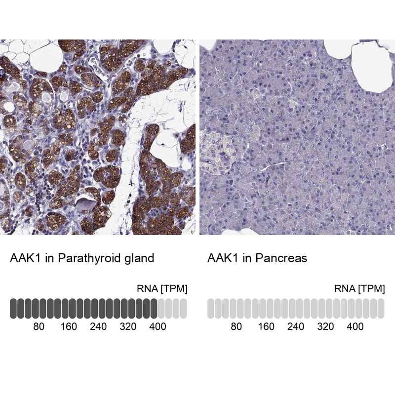 Analysis in human parathyroid gland and pancreas tissues using Anti-AAK1 antibody. Corresponding AAK1 RNA-seq data are presented for the same tissues.
