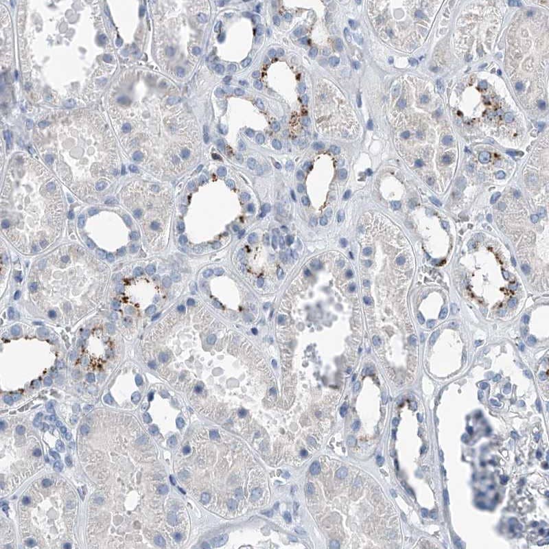 Staining of human kidney shows strong granular positivity in a fraction of cells in tubules.