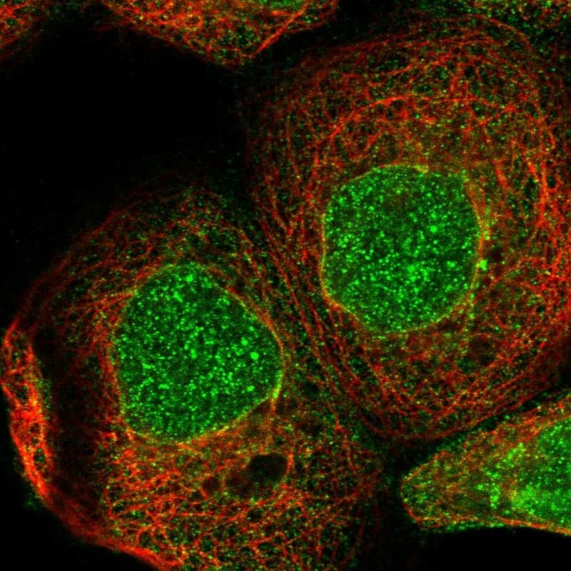 Staining of human cell line A-431 shows localization to nucleus, nuclear membrane & cytosol.