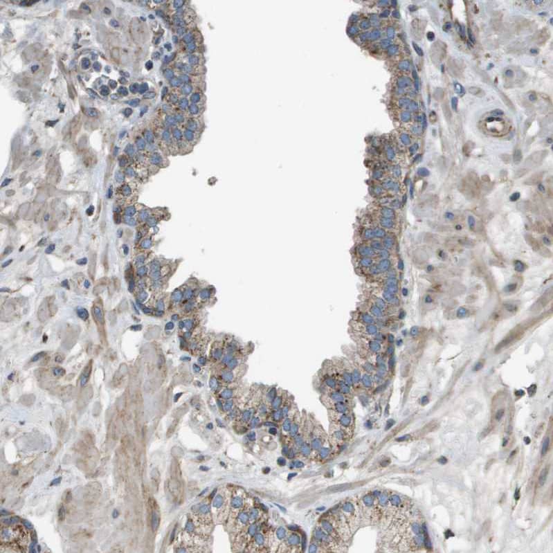 Immunohistochemistry-Paraffin NRK Antibody - BSA Free