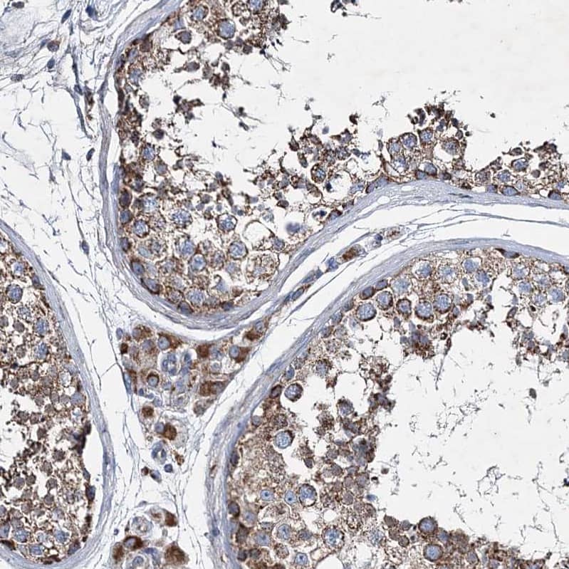 Immunohistochemistry-Paraffin SPAG16 Antibody - BSA Free