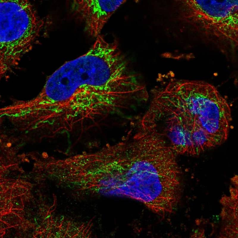 Staining of human cell line U-251 MG shows localization to mitochondria.