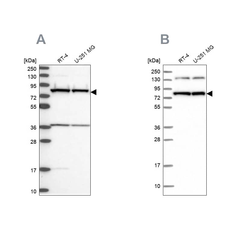 <b>Independent Antibodies Validation. </b>Analysis using Anti-PTCD3 antibody NBP1-84126 (A) shows similar pattern to independent antibody NBP1-84125 (B).