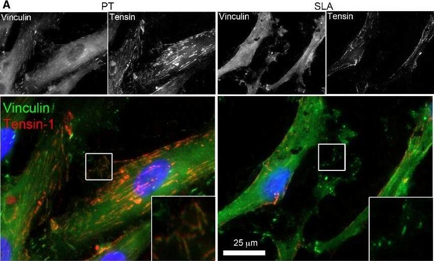 Immunocytochemistry/ Immunofluorescence Tensin 1 Antibody - BSA Free