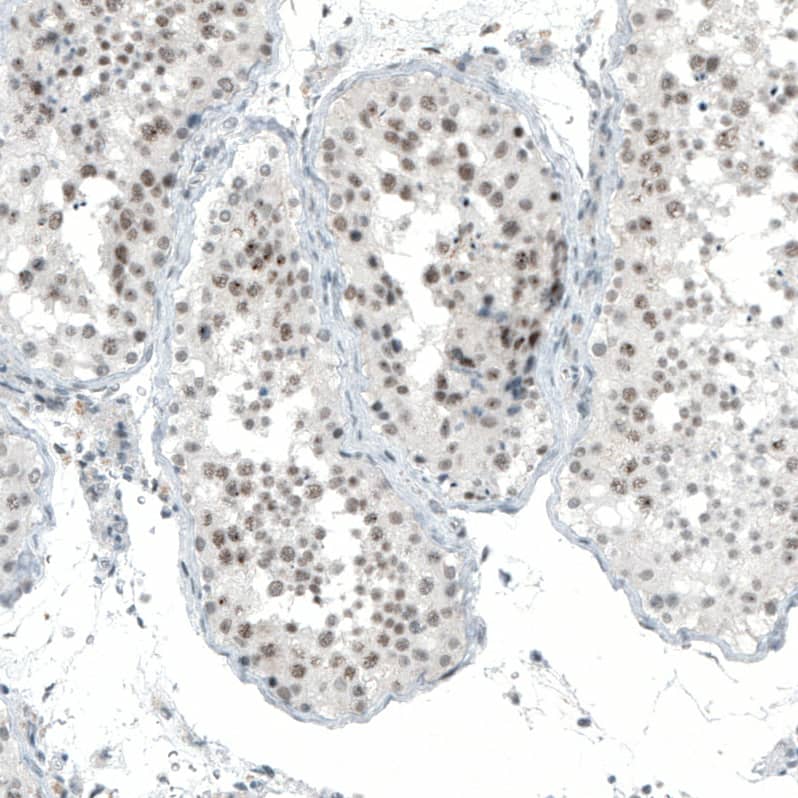 Immunohistochemistry-Paraffin MED20 Antibody - BSA Free