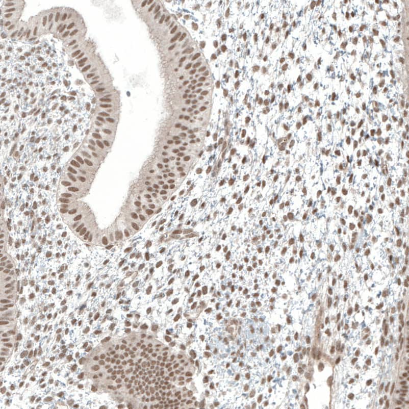 Staining of human endometrium shows moderate nuclear positivity.