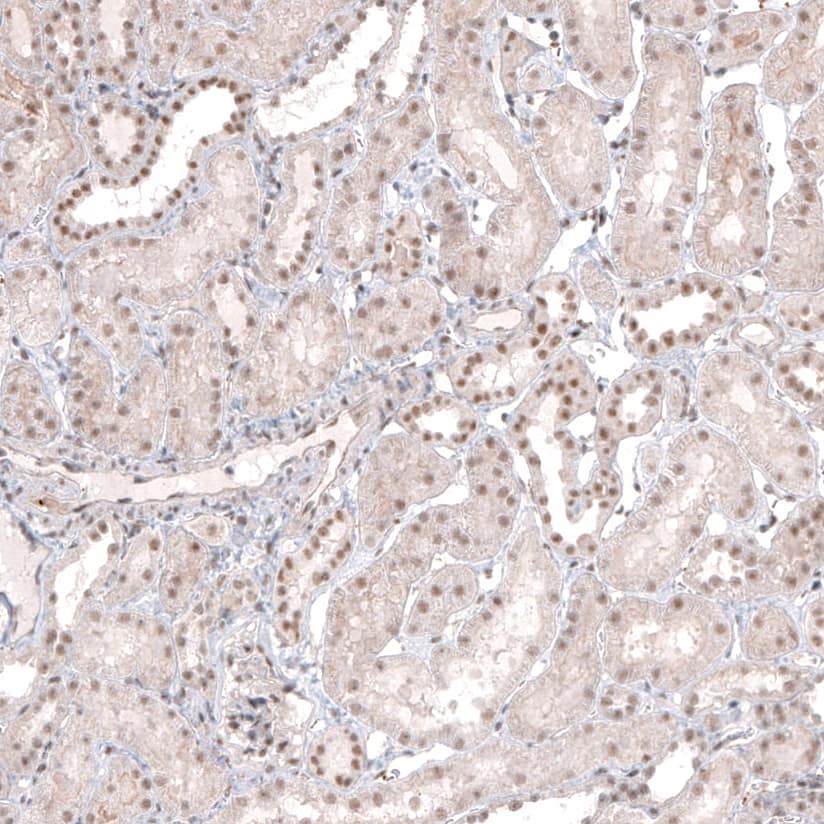 Staining of human kidney shows moderate nuclear positivity in cells in tubules.