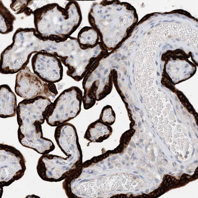 Immunohistochemistry-Paraffin KIF1-binding protein Antibody - BSA Free
