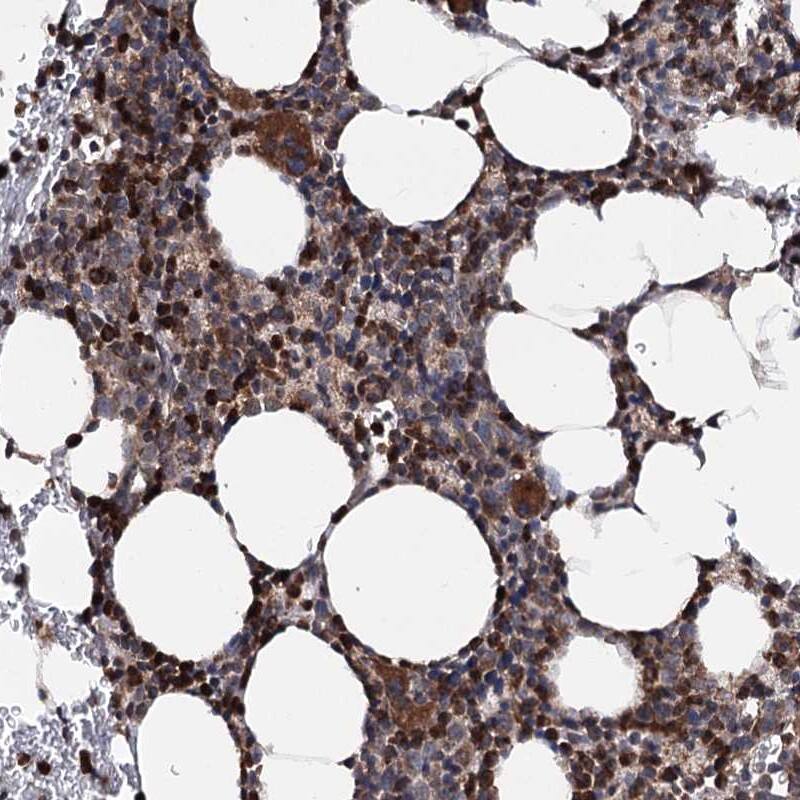 Staining of human bone marrow shows strong cytoplasmic positivity in bone marrow poietic cells.