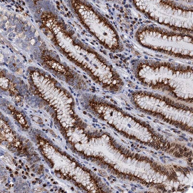 Staining of human stomach, upper shows strong granular cytoplasmic positivity in glandular cells.