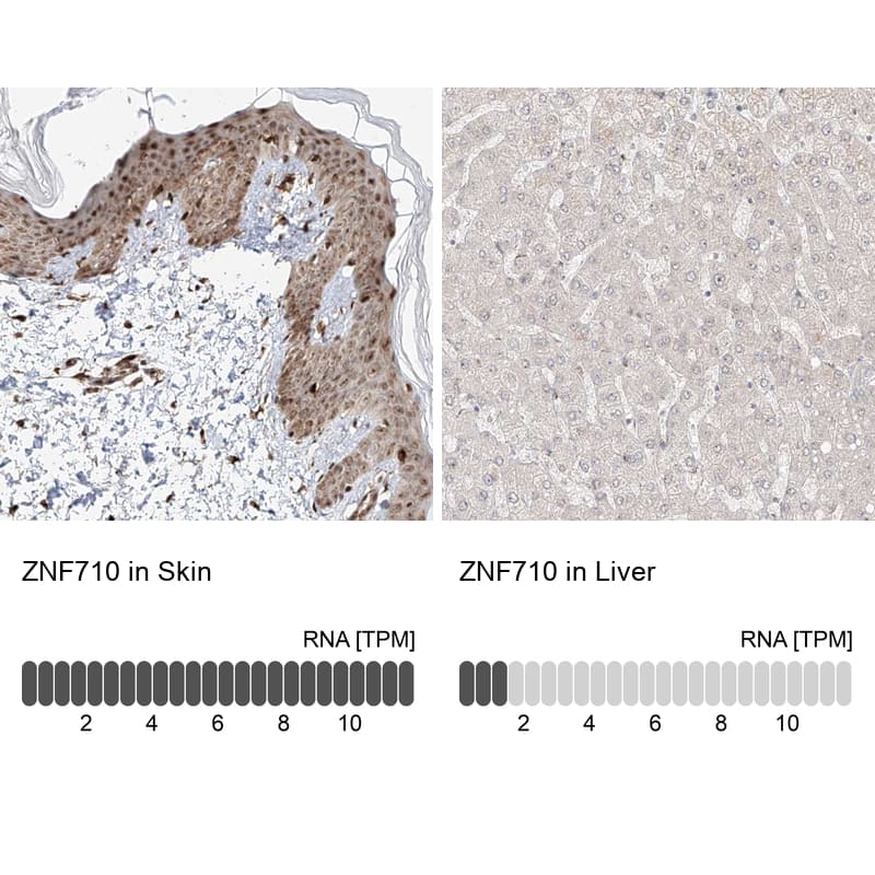 <b>Orthogonal Strategies Validation. </b>Analysis in human skin and liver tissues.