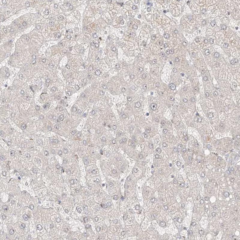 Staining of human liver shows low expression as expected.