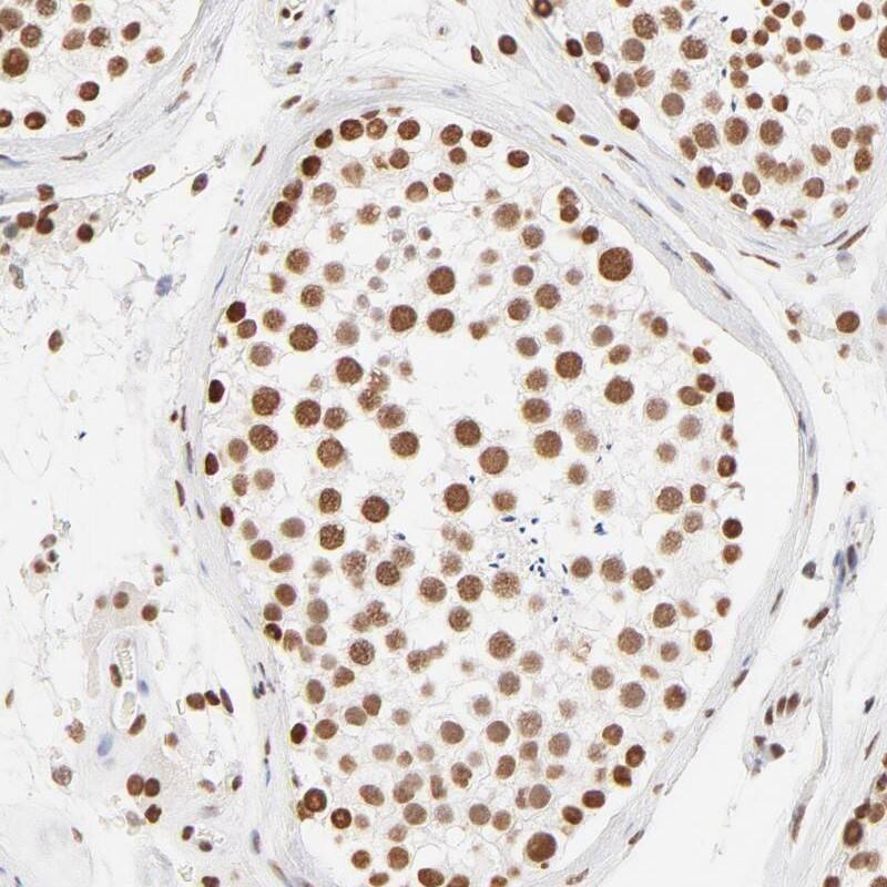Staining of human testis shows strong nuclear positivity in cells of seminiferus ducts.