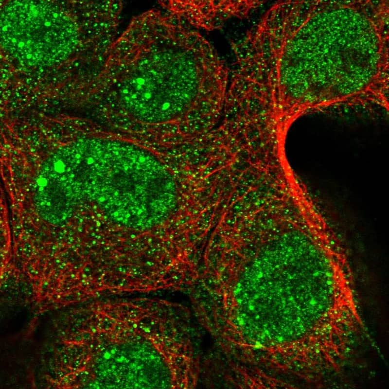 Staining of human cell line A-431 shows localization to nucleoplasm, nuclear bodies & plasma membrane.