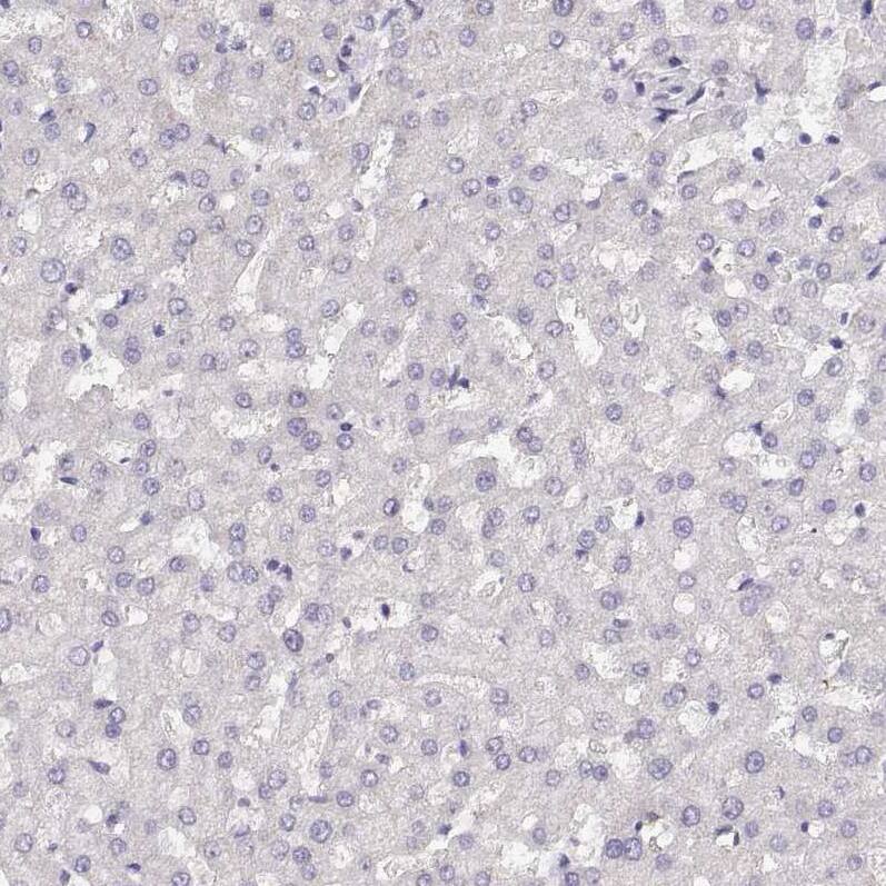Staining of human liver shows no positivity in hepatocytes as expected.
