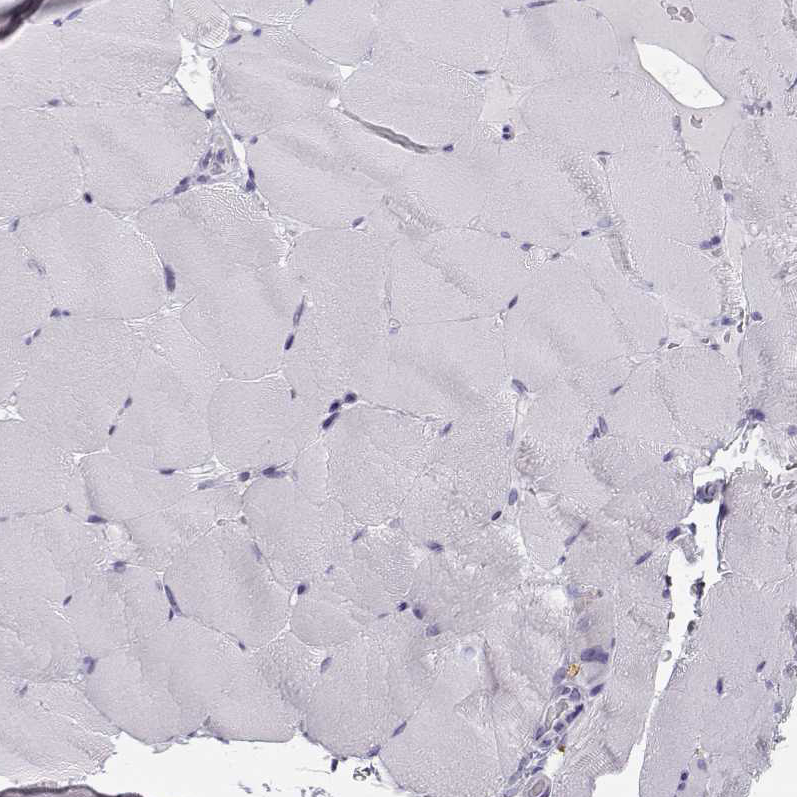 Staining of human skeletal muscle shows no positivity in myocytes as expected.