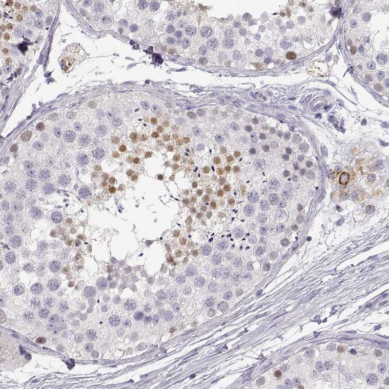 Staining of human testis shows weak to moderate nuclear positivity in a subset of cells in seminiferous ducts.