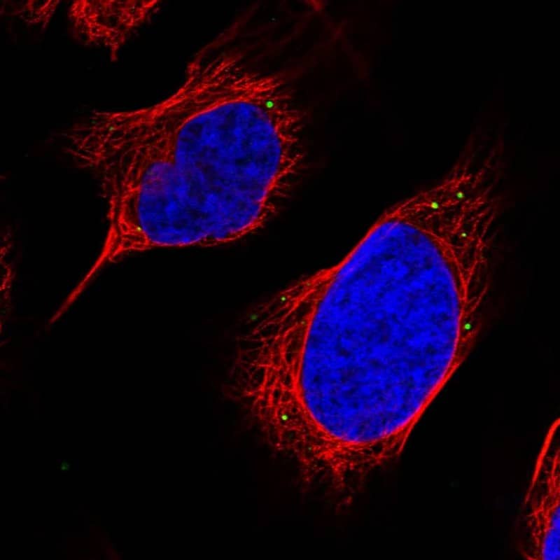 Staining of human cell line U-2 OS shows localization to vesicles.