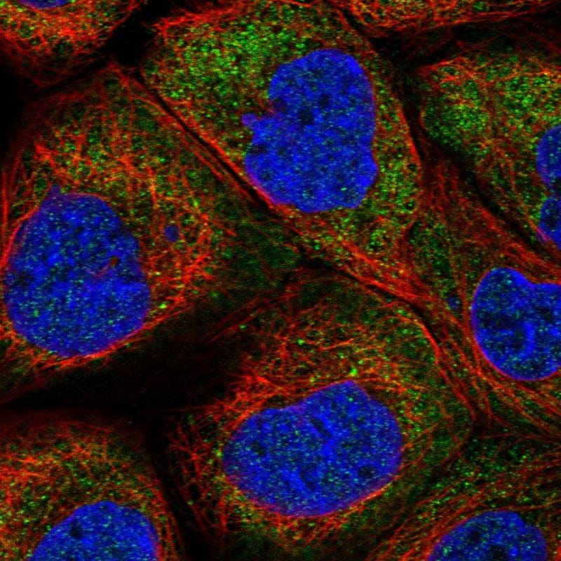 Staining of human cell line A-431 shows localization to cytosol.