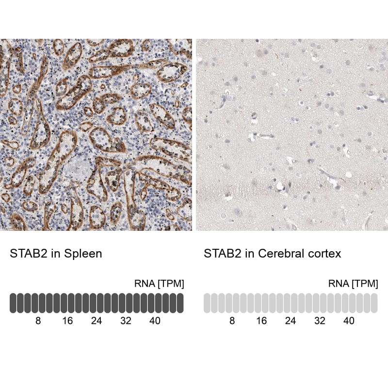 Immunohistochemistry-Paraffin Stabilin-2 Antibody - BSA Free