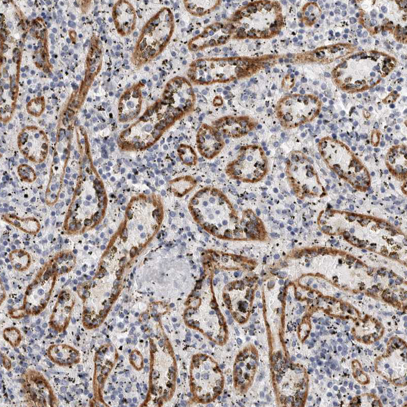 Immunohistochemistry-Paraffin Stabilin-2 Antibody - BSA Free