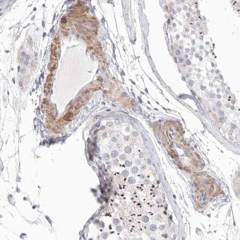 Staining of human testis shows moderate cytoplasmic positivity in endothelial cells.