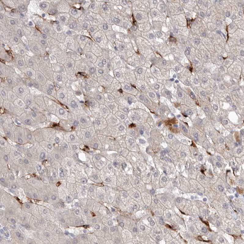 Staining of human liver shows moderate to strong cytoplasmic positivity in hepatic sinusoid cells.