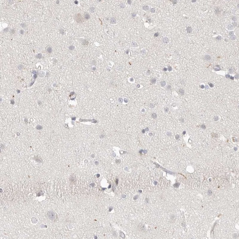 Staining of human cerebral cortex shows low expression as expected.