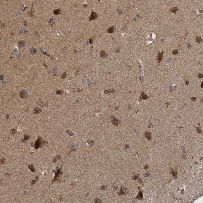 Staining of human cerebral cortex shows strong cytoplasmic positivity in neurons.