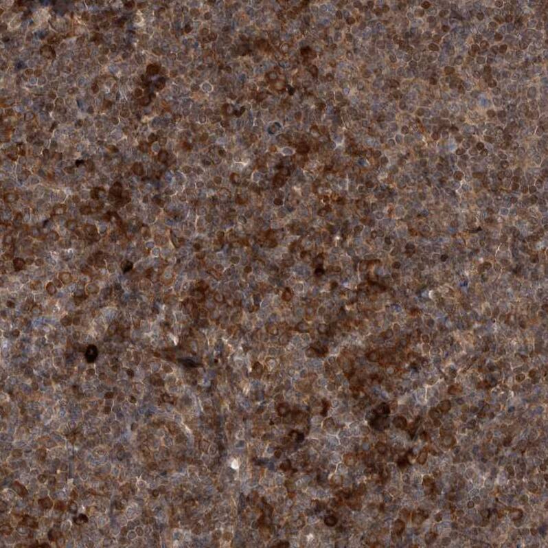 Staining of human tonsil shows strong cytoplasmic positivity in non-germinal center cells.