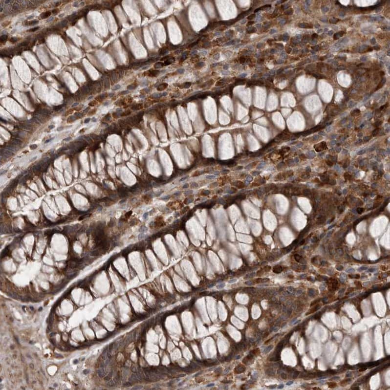 Staining of human rectum shows strong cytoplasmic positivity in glandular cells.