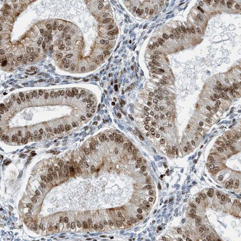Staining of human endometrium shows moderate nuclear/cytoplasmic-nuclear/nuclear membranous positivity in glandular cells and stromal cells.