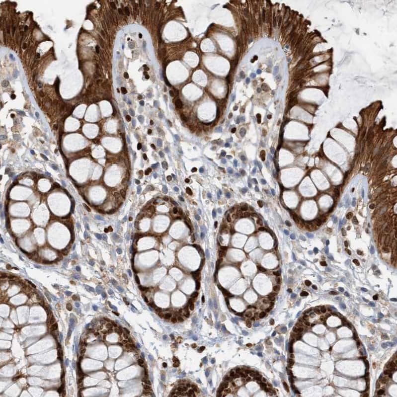 Staining of human colon shows strong cytoplasmic-nucleus positivity in glandular cells and nucleus positivity in lymphoid cells,