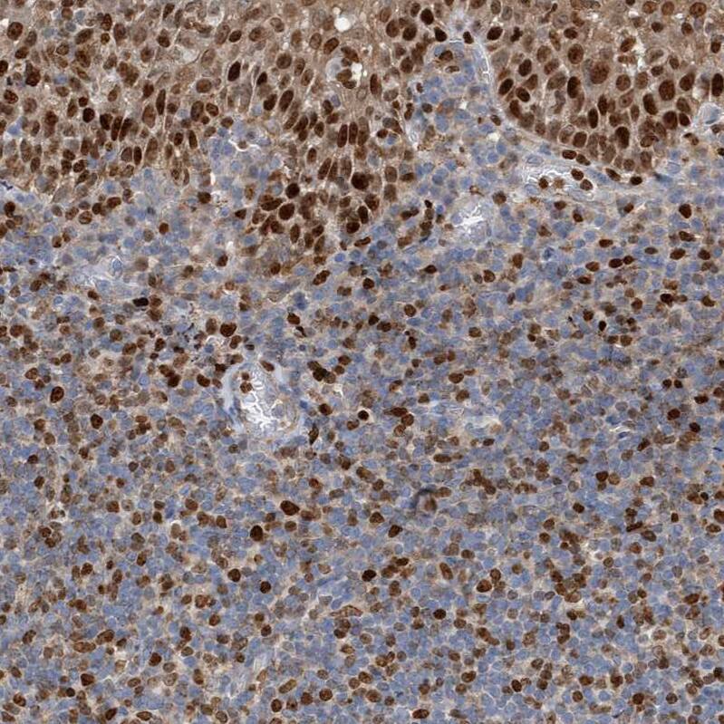 Immunohistochemistry-Paraffin SH3D19 Antibody - BSA Free
