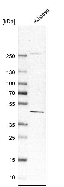 Analysis in human adipose tissue.