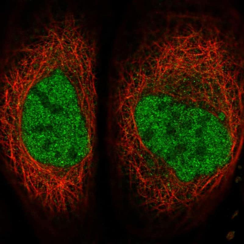 Staining of human cell line A-431 shows localization to nucleoplasm.