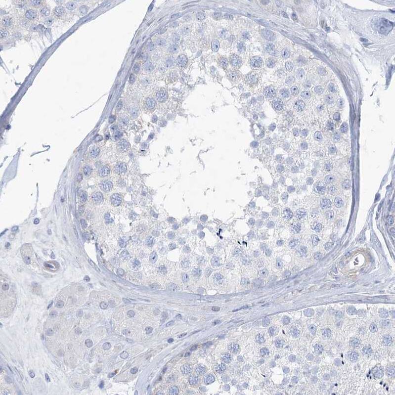 Immunohistochemistry-Paraffin MOXD1 Antibody - BSA Free