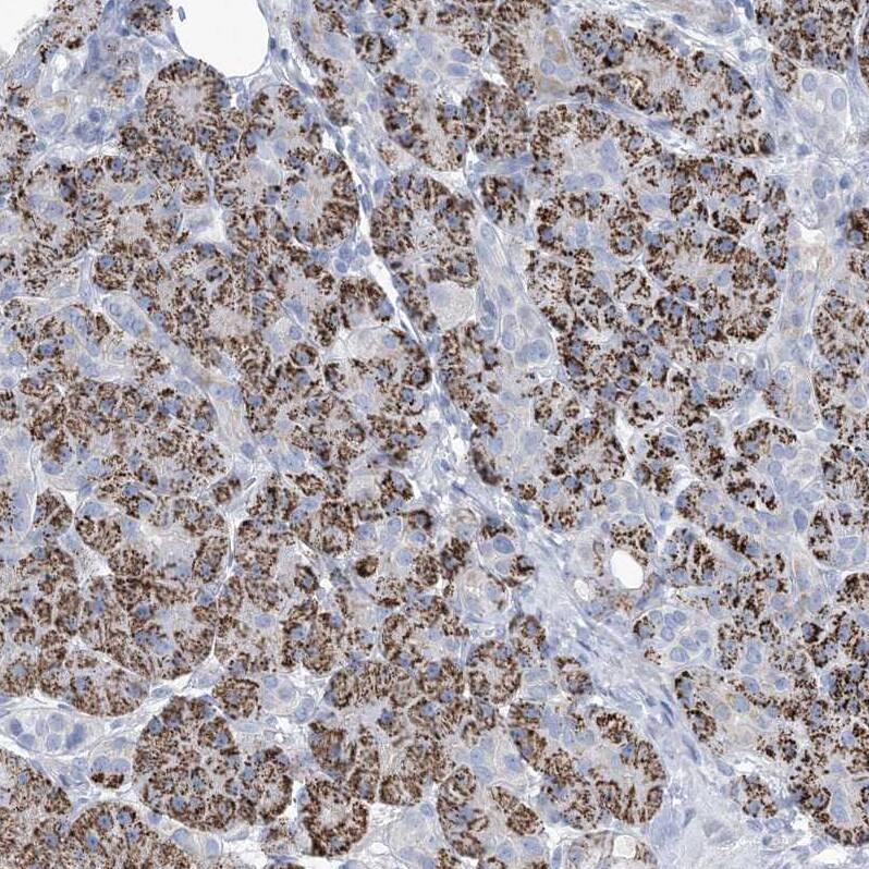 Immunohistochemistry-Paraffin MOXD1 Antibody - BSA Free