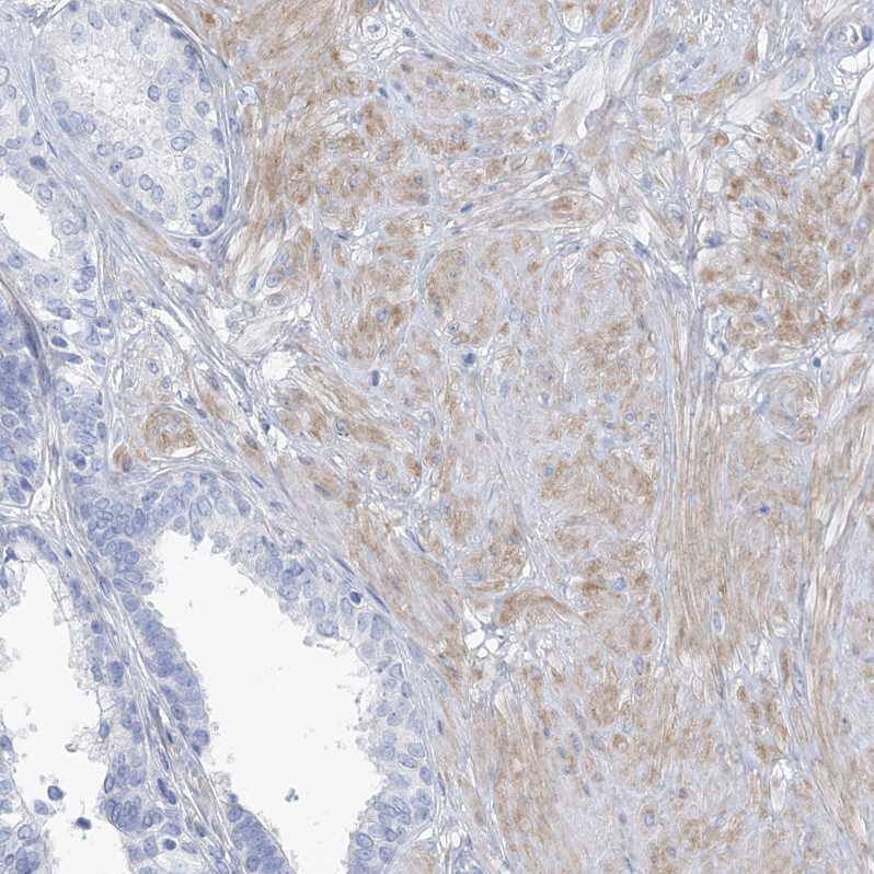 Immunohistochemistry-Paraffin MOXD1 Antibody - BSA Free
