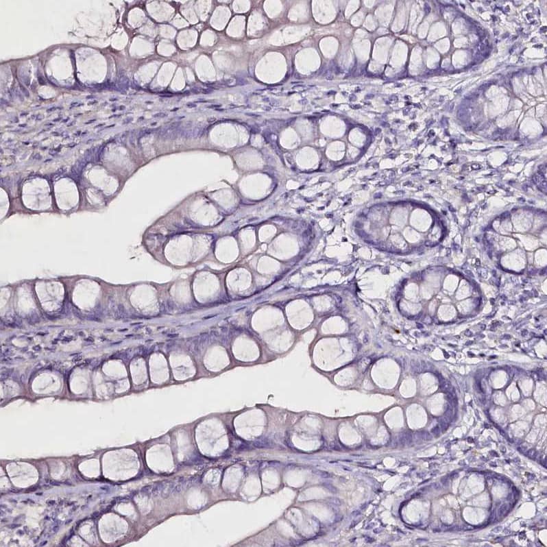 Staining of human small intestine shows no positivity in glandular cells as expected.