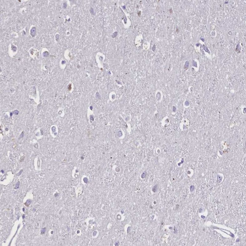 Staining of human cerebral cortex shows no positivity in neuronal cells as expected.